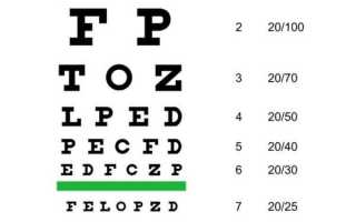 Визометрия глаза это: что значит в офтальмологии, расшифровка показателей