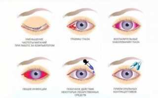 Дефислез глазные капли – инструкция по применению, аналоги