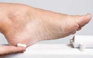 Почему болит большой палец на ноге