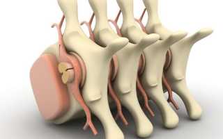 Чем опасен остеохондроз и можно ли его вылечить?