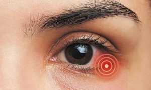 Тобразон глазные капли – инструкция по применению, аналоги