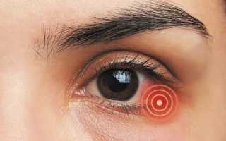 Тобразон глазные капли – инструкция по применению, аналоги