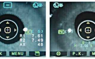 Рефрактометрия: расшифровка показателей и что это такое в офтальмологии