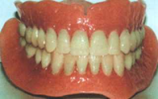 Характеристика фиксирующего крема Протефикс для зубных протезов экстра сильной фиксации: инструкция по применению