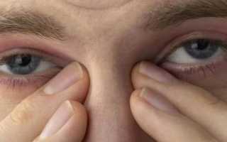 Окутиарз глазные капли: инструкция по применению, аналоги