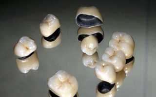 Правила выбора коронок на зубы: какие лучше, цена и особенности несъёмных конструкций для коррекции дефектов зубного ряда