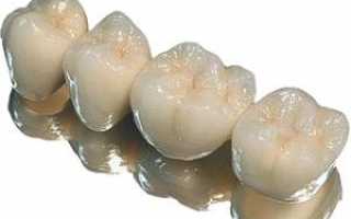 Преимущества коронок из диоксида циркония на передние зубы: фото и особенности ухода за искусственными зубами