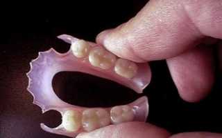 Виды съёмных нейлоновых зубных протезов: цена и фото, особенности и правила ухода