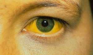Эритромицин мазь – инструкция по применению для глаз для детей