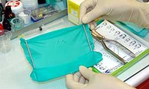 Раббердам или коффердам в стоматологии: влияние латексной защиты на качество лечения зубного ряда
