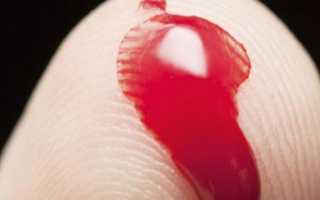 Имплантационное кровотечение – как отличить, сроки наступления