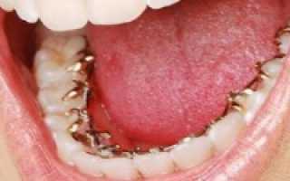 Зубы у детей порядок прорезывания молочных зубов сроки