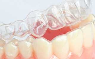 Особенности и правила использования кап для отбеливания зубов: купить в аптеке, цена и противопоказания к применению