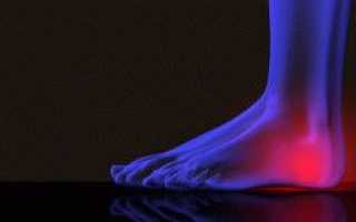 Действенные мази от боли в суставах ног
