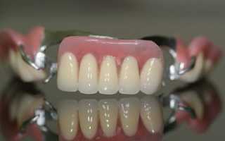 Показания к установке бюгельных зубных протезов: отзывы, цена, разновидности и полезные советы по привыканию к зубным конструкциям