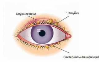 Катахром – инструкция по применению глазных капель, аналоги