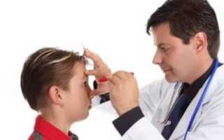 Вирусный конъюнктивит глаз: лечение у детей – симптомы и капли для лечения