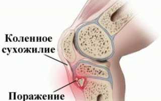 Почему болит колено при приседании на корточки