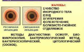 Бактериальный конъюнктивит у детей: лечение ребенка в домашних условиях