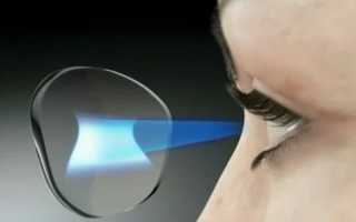 Что такое мультифокальные линзы и как правильно подобрать очки для коррекции зрения