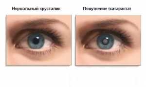 Глазные капли Бестоксол: инструкция, показания к применению, побочные реакции