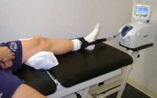 Гонартроз коленного сустава 3 степени